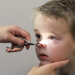 Adenoide em Crianças: sintomas de hipertrofia e quando o otorrinolaringologista indica tratamento